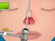 Juego de Operate Now Nose Surgery Online Gratis - Juegosipo.com