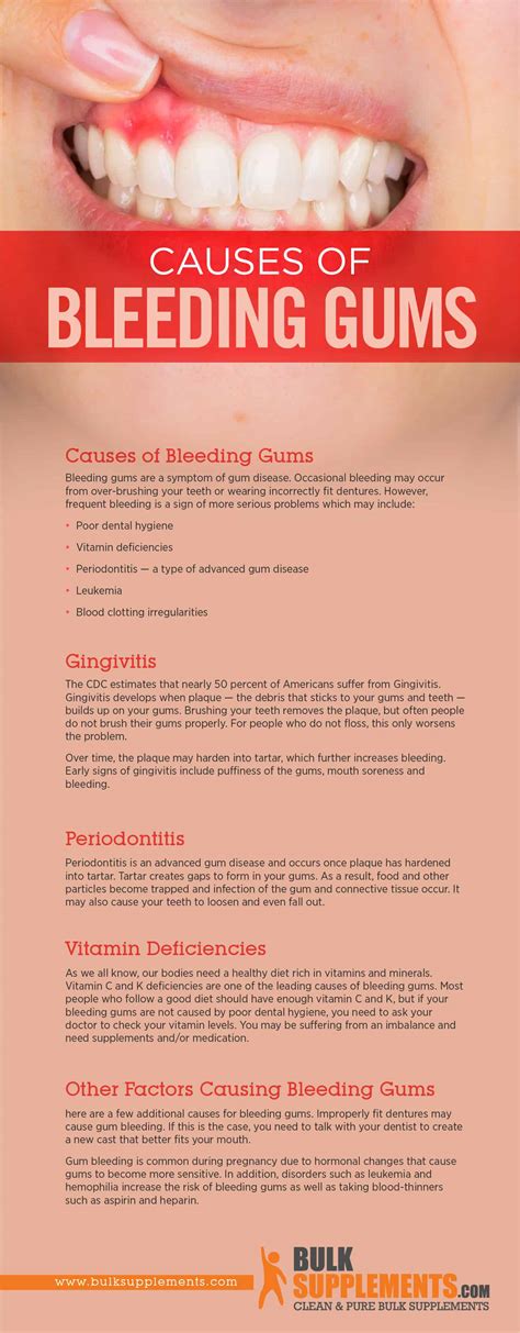 Tablo | Read 'Bleeding Gums: Characteristics, Causes & Treatment' by