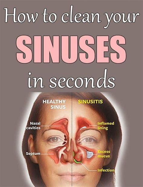 How to clean your sinuses in seconds - Beauty Area | Sinusitis, Sinus remedies, Holistic health