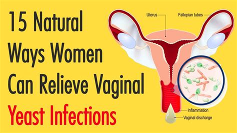 15 Natural Ways Women Can Relieve Vaginal Yeast Infections