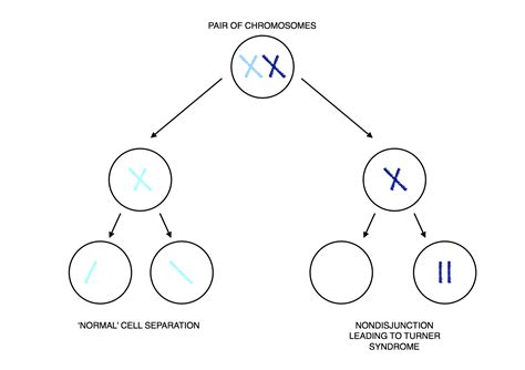 Turner Syndrome