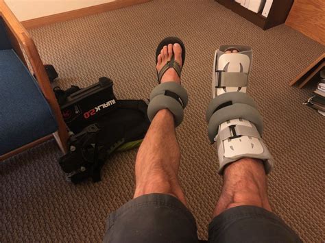 Lisfranc recovery tougher than you think — Tackle Tough Things