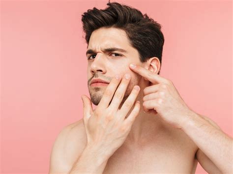 Fibrous Papules of the Face and Nose & How to Remove Them - Team Dermatology