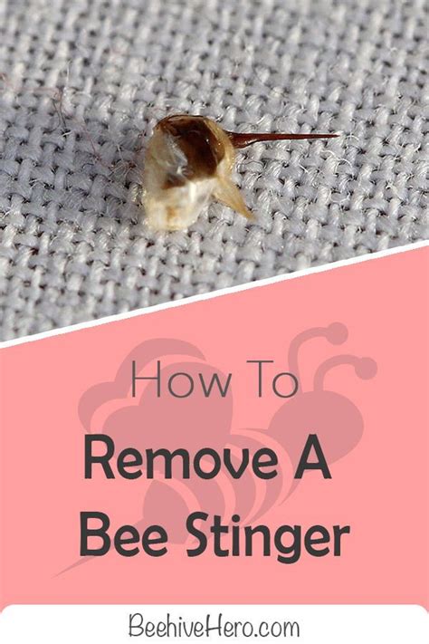 If you get stung by a bee, the most important thing to do is remove the ...