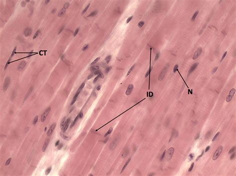 Microscope Cardiac Muscle Cell Labeled - img-stache