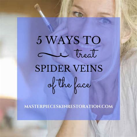 5 Ways to Treat Spider Veins of the Face