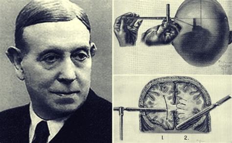 Egas Moniz and the Amazing History of the Lobotomy - Exploring your mind