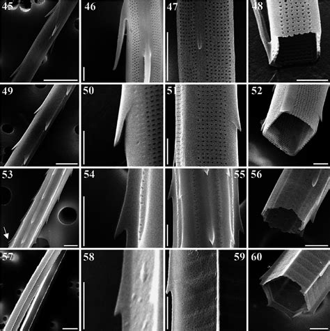 Spines and poroids on a seta of Chaetoceros danicus . SEM stub... | Download Scientific Diagram