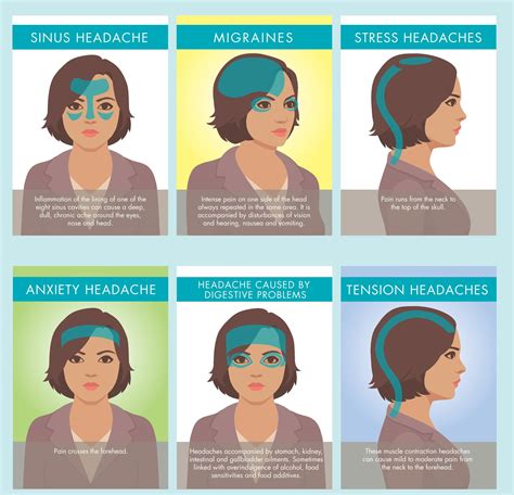 6 Most Common Types of Headaches and their Natural Remedies (with FREE ...