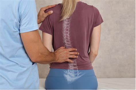 Scoliosis – Non-Surgical Treatment Options - Carolina Rehab and ...