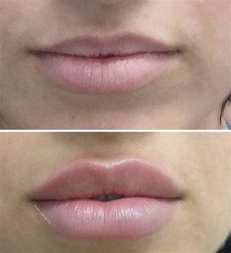 Épinglé sur Lips