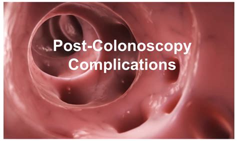 emDOCs.net – Emergency Medicine EducationPost-Colonoscopy Complications ...