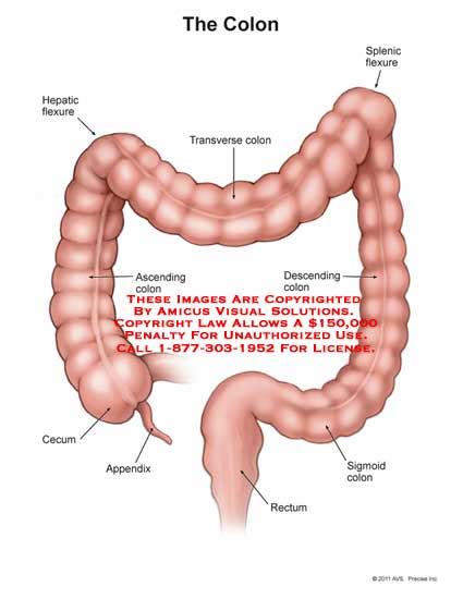 (11168_01A) The Colon – Anatomy Exhibits