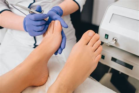 Laser Toenail Fungus Removal | Arizona Foot Doctors