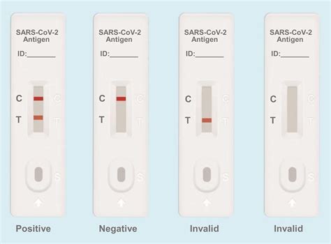 SARS-CoV-2 Antigen Rapid Test Kit (Colloidal Gold) (A254381)