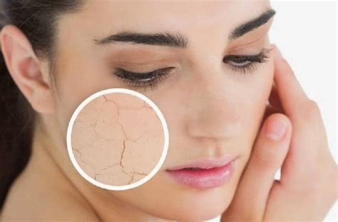 Toma en cuenta estos 4 consejos para tratar la piel seca del cuerpo y rostro – Nueva Mujer