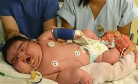 Smallest Baby Ever Born Weighs So Little, Just .88 lbs - Jesus Daily