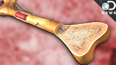 Cancer Of Bone Marrow Is Called - CancerWalls