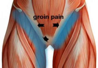 Diagram Of Male Groin Area / ⎯Defining of groin measurement area | Download Scientific ...