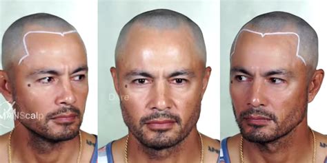 Derek Ramsay gets hyper realistic scalp tattoo | GMA News Online