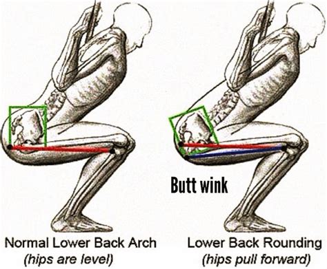 Pin on Glutes maximus