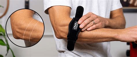 Perfect Tennis Elbow Brace Placement ~ 8-Steps + Pictures