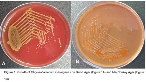 Chryseobacterium Bloodstream Infection in a Case of Non-Hodgkins Lymphoma: An Emerging Pathogen ...