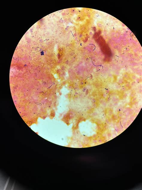 Gram stain from a VERY chunky sputum : r/microbiology