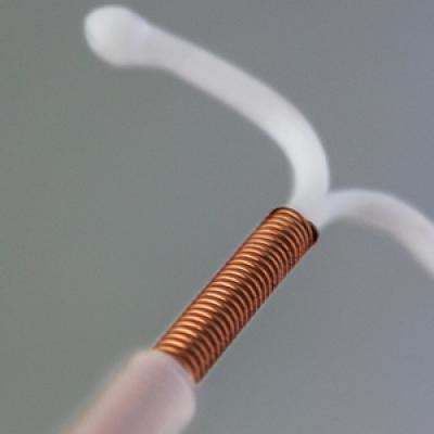 How common is IUD perforation, expulsion, and malposition? | MDedge ObGyn