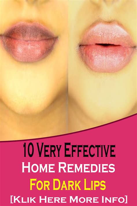 10 Very Effective Home Remedies For Dark Lips - the pins populer 2