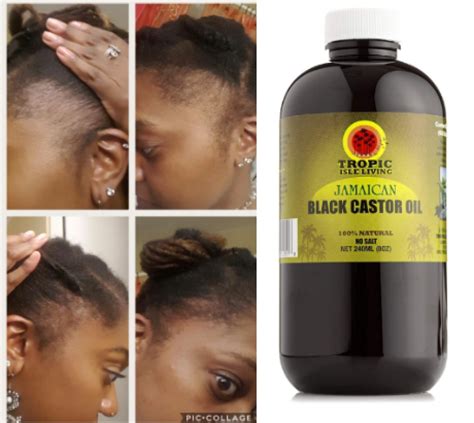 Top 5 Best Fast Hair Growth products in Cameroon for Natural Hair ...