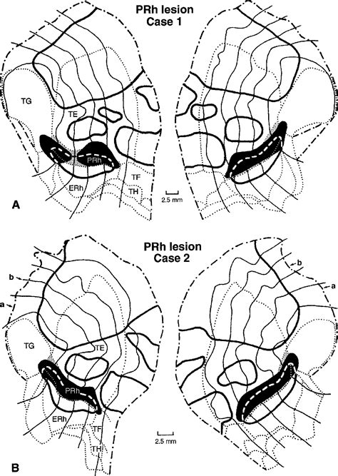 Structure of entorhinal cortex | Semantic Scholar