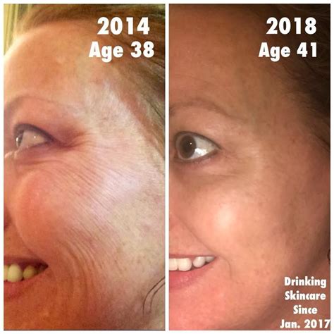 Before and after using this one product! You can experience drastic ...