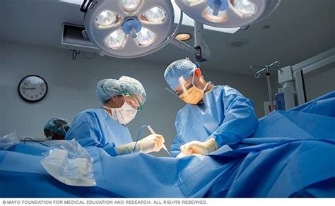 Breast cancer surgery - Care at Mayo Clinic - Mayo Clinic