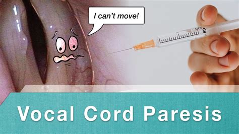 Injection Medialization for Vocal Cord Paresis - YouTube