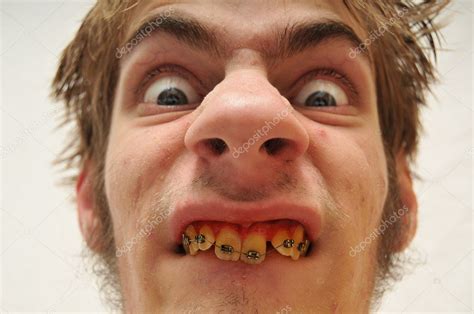 Homem Monstruoso Hideous Olhando Para Câmera Com Olhos Largos Dentes fotos, imagens de © vlue ...