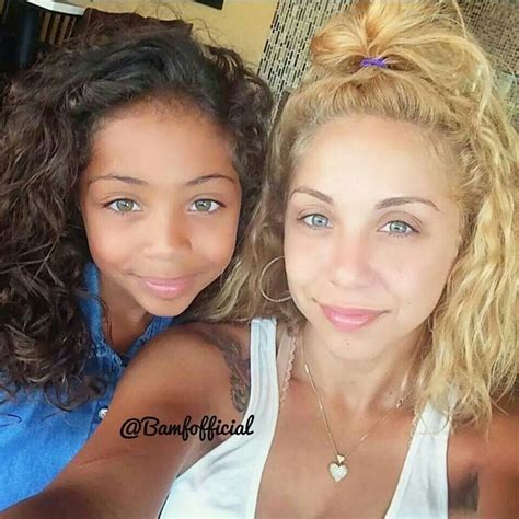 Can Identical Twins Have Different Eye Colors