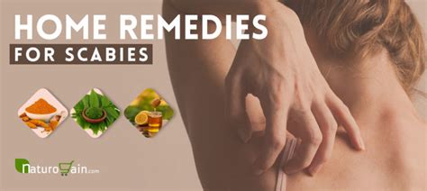 6 Home Remedies for Scabies - Herbal Treatments that Work