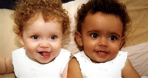 The twin sisters were born with different skin and hair colors. They are already 14 years old