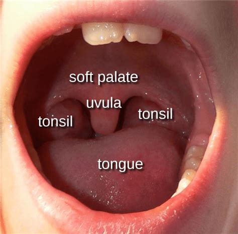 What are tonsils and adenoids? – ENT 4 kids