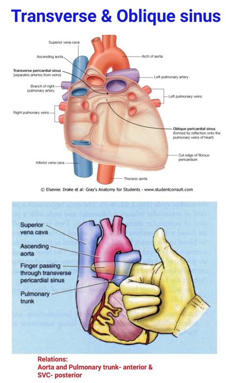 Transverse & Oblique Sinus ... | Medical students, Medical, Med student