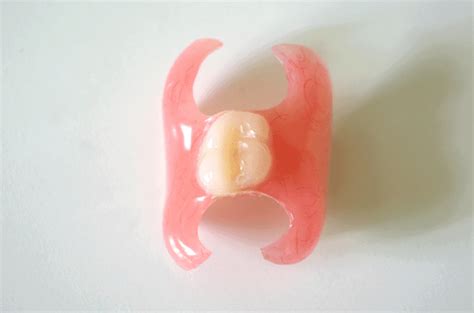 A Single Tooth Denture Can Be A Great Way To Restore Your Smile - Teeth ...