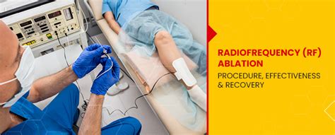 Radio frequency (RF) Ablation: Procedure, Effectiveness, and Recovery