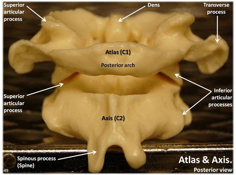 😎 Atlas and axis. Upper Cervical Spine Disorders: Anatomy of the Head ...