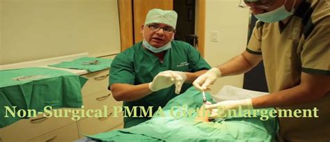 PMMA Girth Enhancement Injections - Surgery LIFE Enhancement