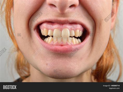 Close Healthy Teeth Image & Photo (Free Trial) | Bigstock