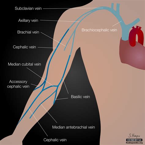 Upper Extremity Artery Anatomy