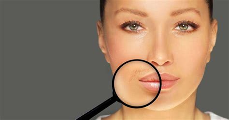 Here Are Some Tried And Tested Methods For Upper Lip Hair Removal - Lazer MedSpa News