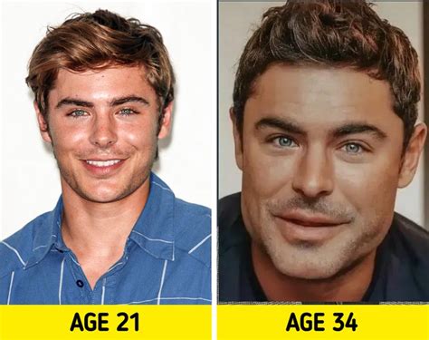 Zac Efron S Chin Injury And Plastic Surgery Explained - vrogue.co