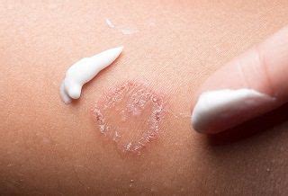 Top 11 Best Antifungal Creams for Ringworm: Reviews & Guide 2020 trong 2020 | Khăn tắm, Khỏe mạnh